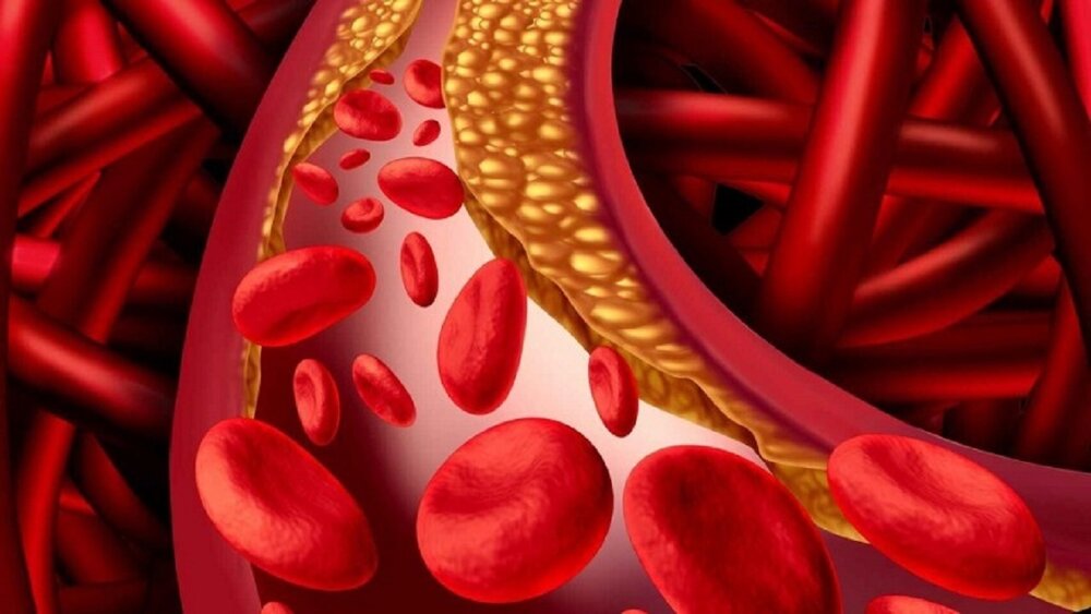 آیا کلسترول خوب خطر بروز بیماری‌های قلبی را کاهش می‌دهد؟