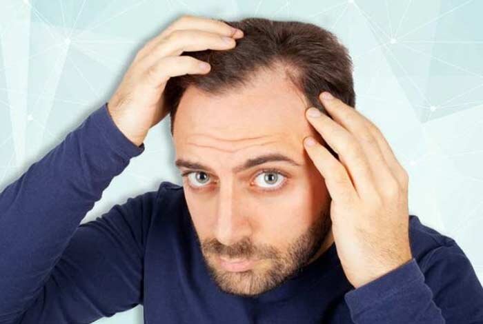 علت ریزش مو چیست؟+ راهکار کنترل و درمان