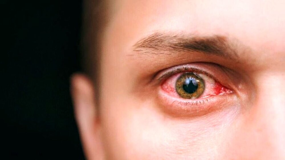 با اسکن شبکیه چشم بیماری کلیوی را تشخیص دهید