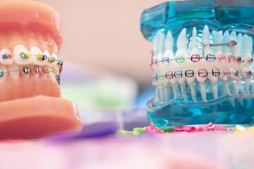 ارتودنسی دندان چه مدت طول می کشد و روش های مراقبت از آن چگونه است؟