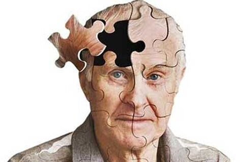 علائم بیماری آلزایمر چیست؟