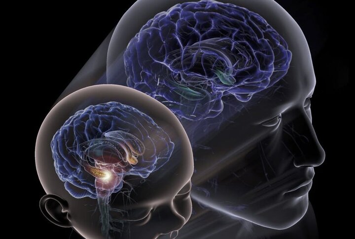احتمال درمان اختلالات مغزی با هوش مصنوعی