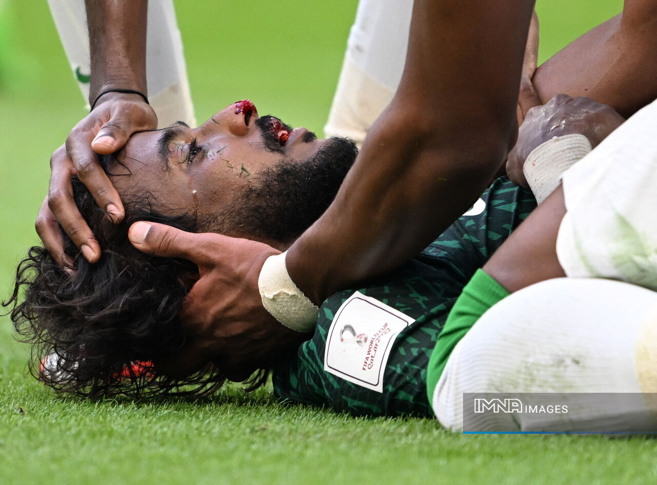 لحظه به لحظه با مصدومیت دردناک یاسر الشهرانی+عکس