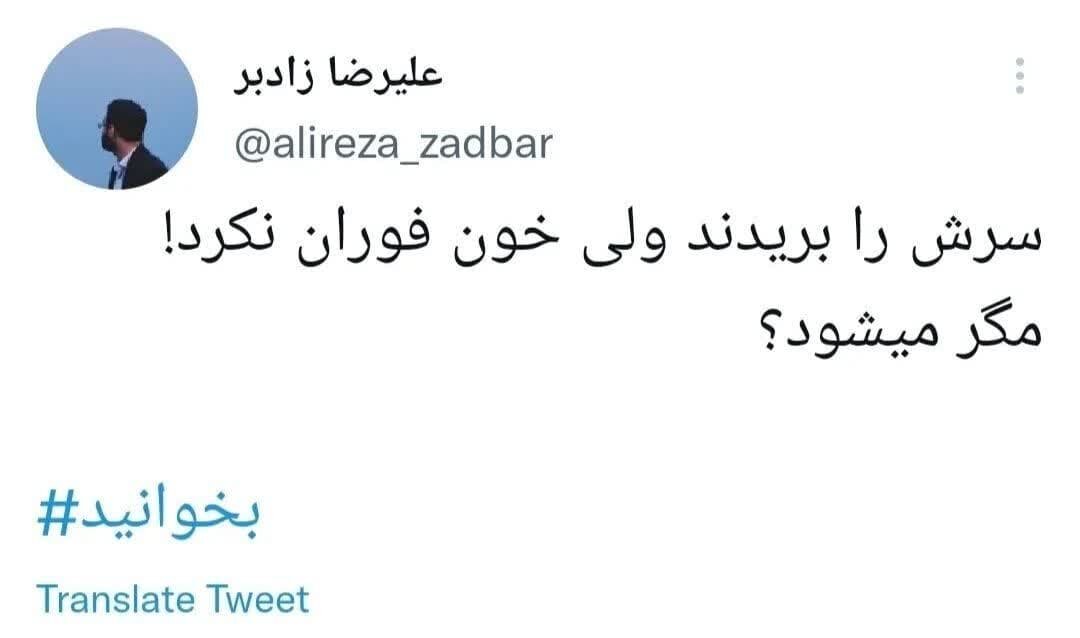 سری که بریده شد، خونی که فوران نکرد