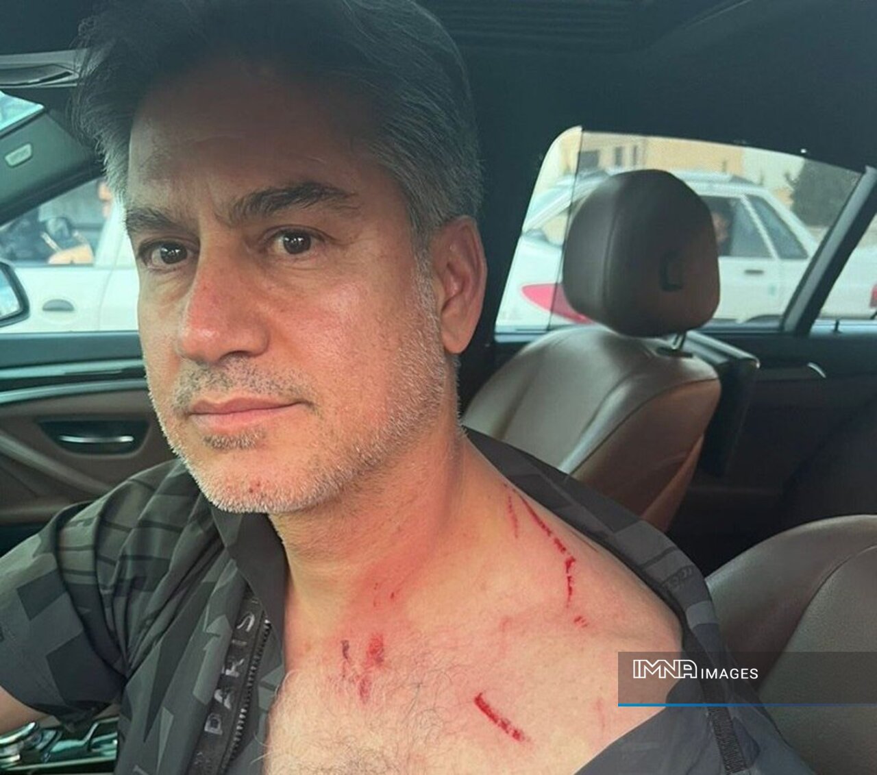 حمید مطهری مورد حمله سارقان قرار گرفت +عکس