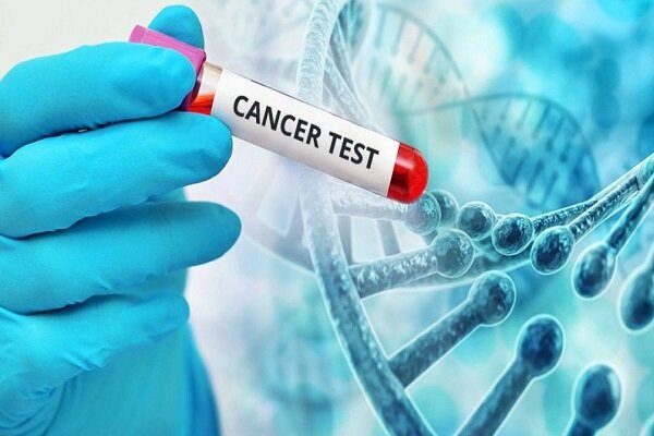 غربالگری رایگان ۳ نوع سرطان در اصفهان/ ۴۰ درصد سرطان‌ها با تشخیص زودهنگام قابل درمان است