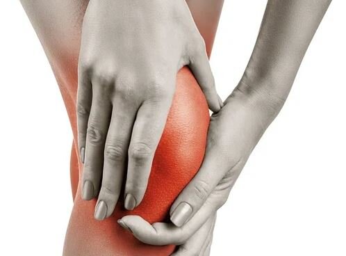 تورم یکی از علائم آرتروز زانو