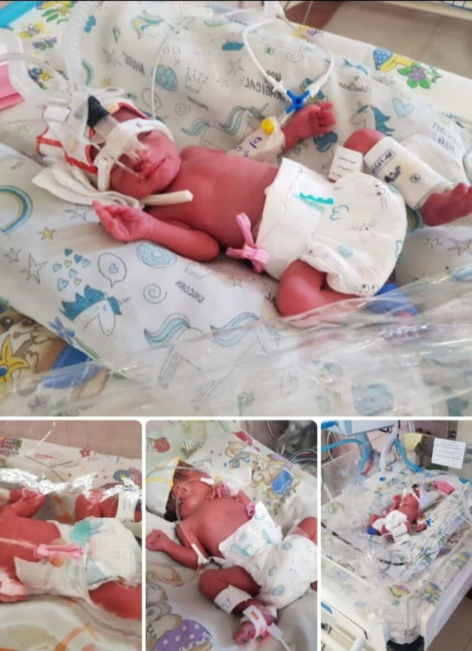 تولد نوزادان ۴ قلو در اصفهان+ عکس
