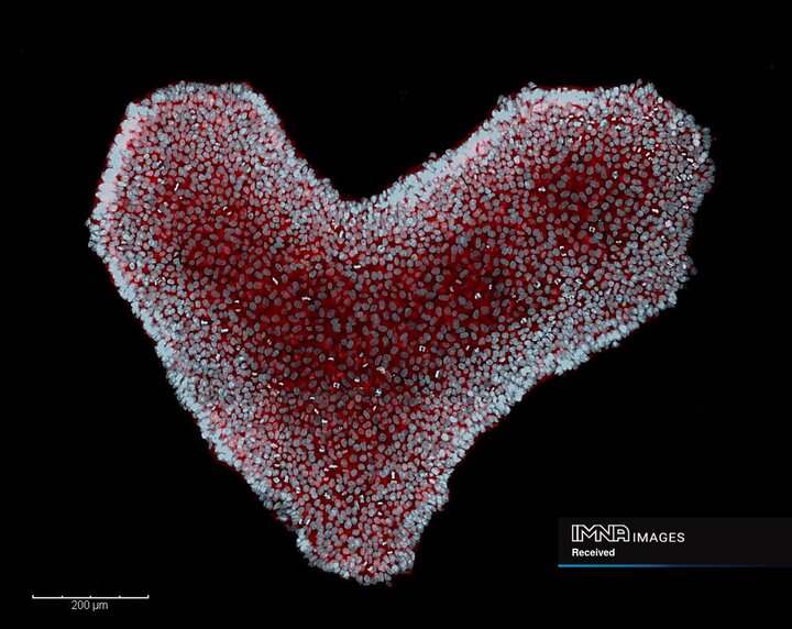 علم سلول های بنیادی گاهی اوقات می تواند قلب شما را به تپش وادار کند. این کلنی سلول های بنیادی جنینی انسان متشکل از صدها سلول است که به شکلی آشنا و دوست داشتنی در کنار هم قرار گرفته اند.