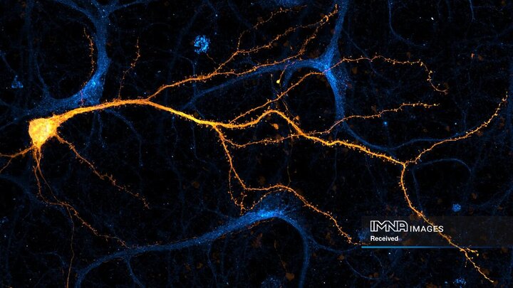 تصویربرداری از نورون‌های هیپوکامپ کشت‌شده (تکه‌های زرد) که در برابر آنزیم اصلاح‌کننده چربی درون‌زا DDHD2 (بیت‌های آبی) رنگ‌آمیزی شده‌اند