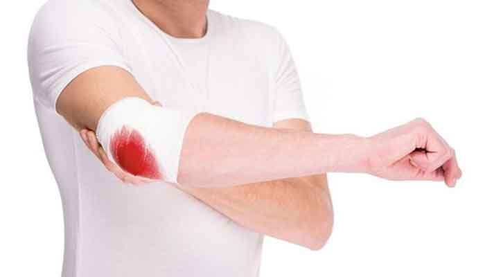 روایتی از زخم بیمرهم بیماران هموفیلی