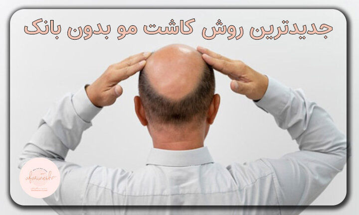 وقت آن رسیده افرادی که بانک مو ندارند با کچلی خداحافظی کنند! وقت آن رسیده افرادی که بانک مو ندارند با کچلی خداحافظی کنند!