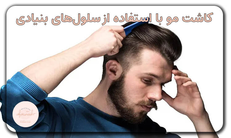 کاشت مو با استفاده از سلول های بنیادی