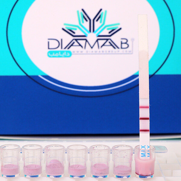 بومی سازی کیتهای تشخیص سریع Rapid Test در کشور