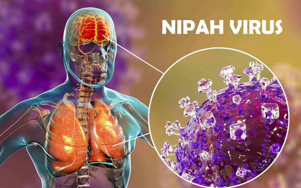 نیپا؛ ویروس جدید هندی (NiV) + علایم کشنده Nipah