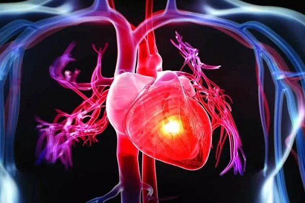 علائم رایج گرفتگی رگ‌های قلب کدام است؟