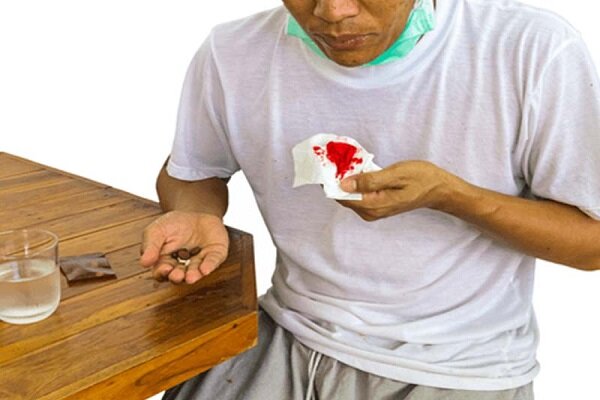 خطر سل نهفته در بدن / ضرورت بیماریابی فعال برای پیشگیری و درمان به موقع