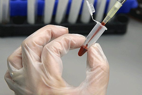 ذخیره‌سازی ۲۱۰ هزار نمونه خون بندناف در سطح کشور