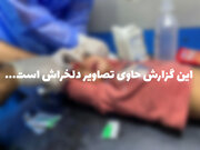 بیمارستان های غزه در آستانه فروپاشی