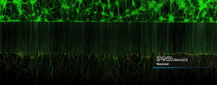 نگاهی از نزدیک به نورون های حرکتی مسئول حرکت ماهیچه ها. با مشاهده این نورون‌ها در سطح سلولی و مولکولی، محققان می‌توانند استراتژی‌های درمانی جدیدی برای مقابله با بیماری‌های تخریب‌کننده عصبی مانند ALS یا بیماری Lou Gehrig بیاموزند.