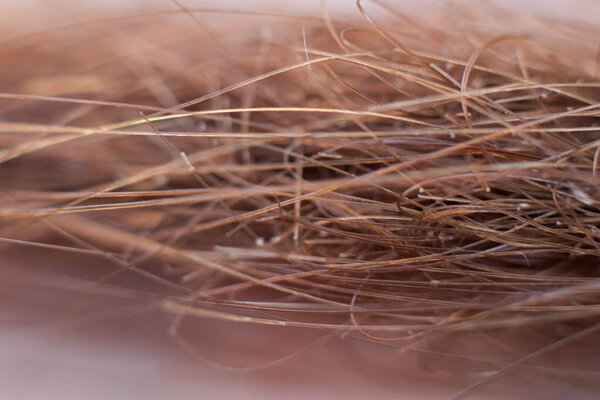 خواص روغن آرگان برای موخوره؛ میهمان ناخوانده موهای شما