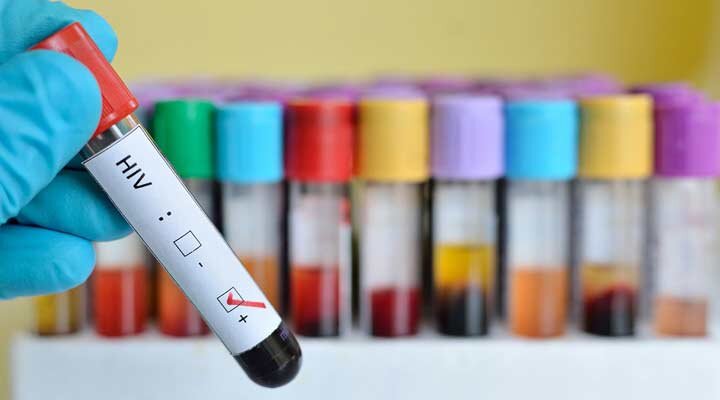 انجام آزمایش پیشرفته NAT برای غربالگری خون‌های اهدایی جهت تشخیص هپاتیت و HIV