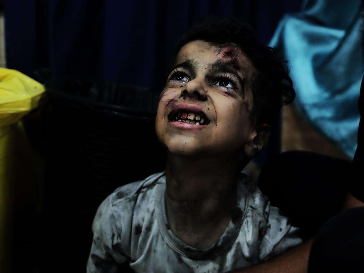روز جهانی یتیمان جنگی ۲۰۲۴ + شعار و شمار کودکان قربانی در غزه