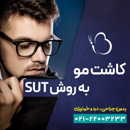 کاشت مو به روش SUT چیست و چقدر هزینه دارد ؟