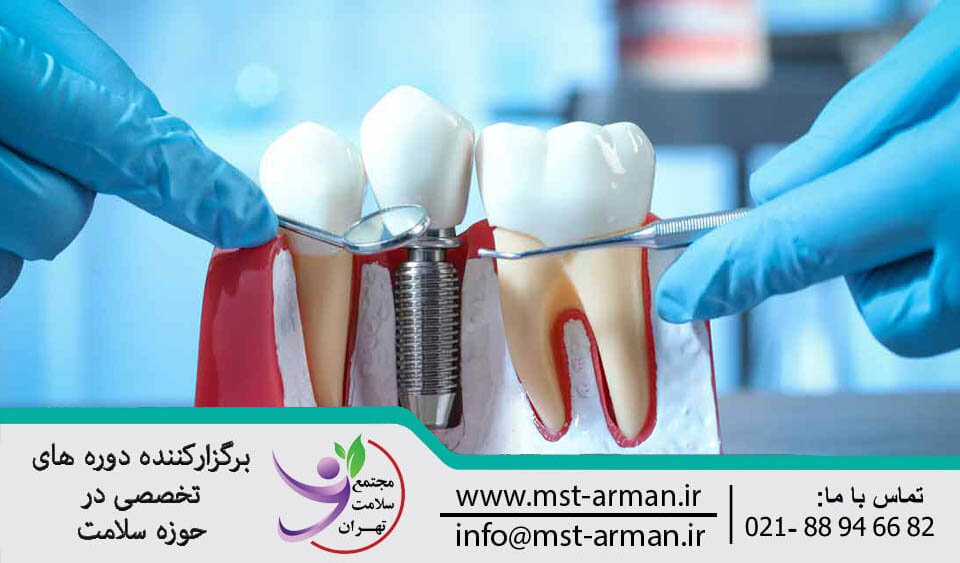 دوره ایمپلنت دندان