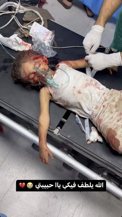 ۱۰۰هزار فلسطینی؛ قربانی ۱۰۰ روز جنگ در غزه