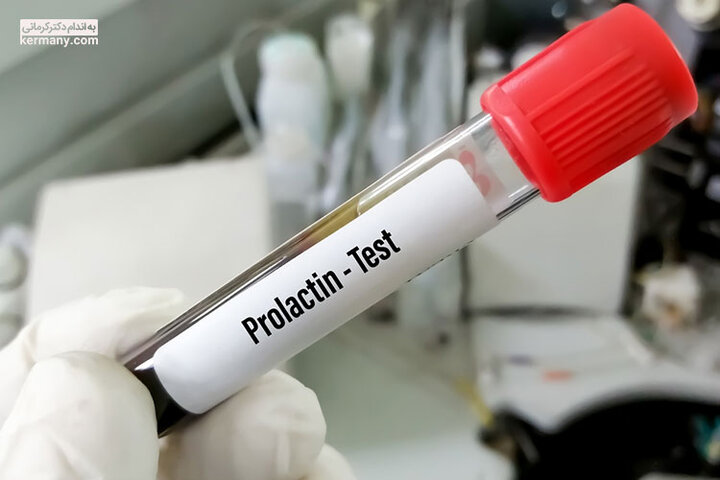 پرولاکتین بالا در زنان: چه زمانی باید نگران شد؟ پرولاکتین بالا در زنان: چه زمانی باید نگران شد؟