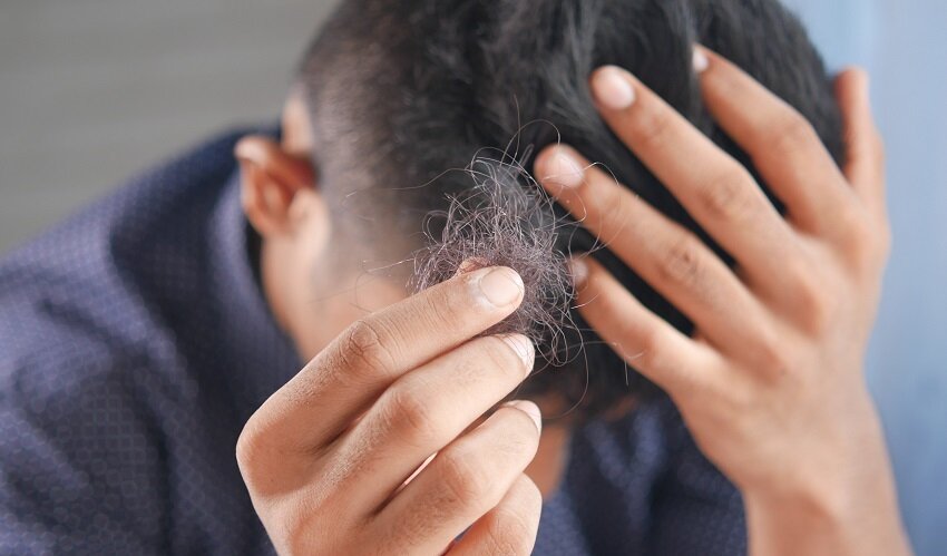 علت ریزش مو چیست؟ + راهکار کنترل و درمان