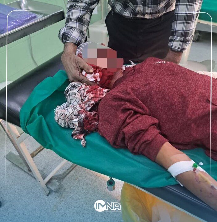 مصدومیت نوجوان ۱۴ ساله کرمانی در چهارشنبه سوری