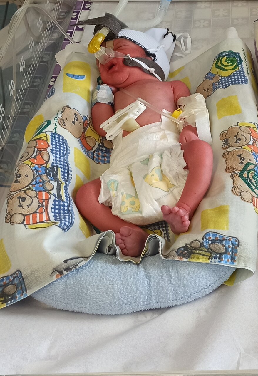 ثبت تولد اولین ۴ قلوهای اصفهانی در سال ۱۴۰۳ + عکس و اسامی نوزادان