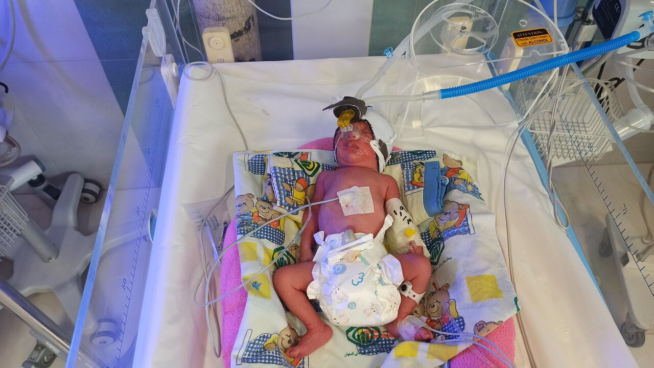 ثبت تولد اولین ۴ قلوهای اصفهانی در سال ۱۴۰۳ + عکس و اسامی نوزادان