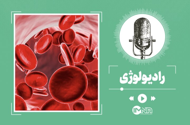 از کجا بفهمیم کم خونی داریم؟ + علائم و درمان