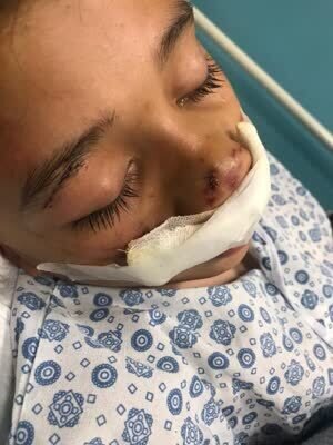 ماجرای گازگرفتگی کودک کرجی چه بود؟