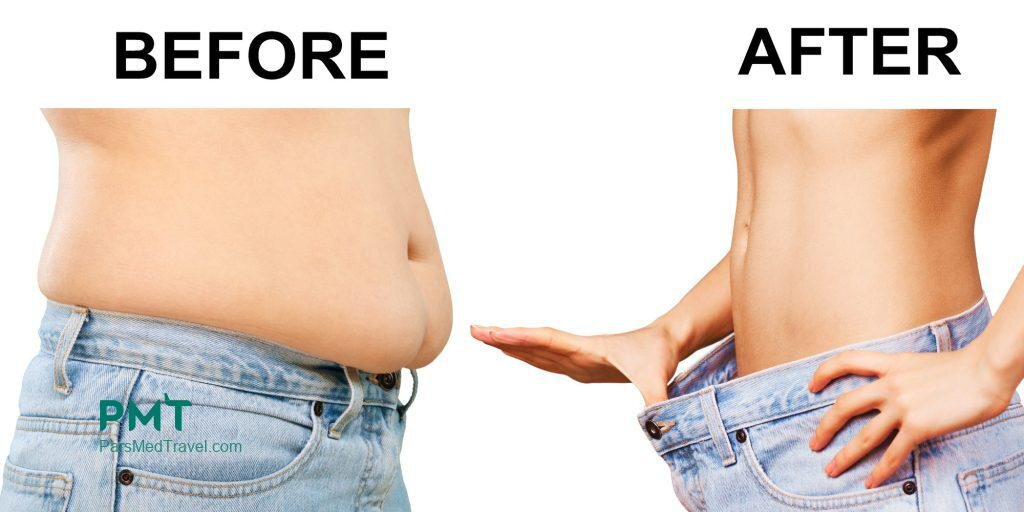 Health Tourism in Iran: A Haven for Arab Medical Tourists