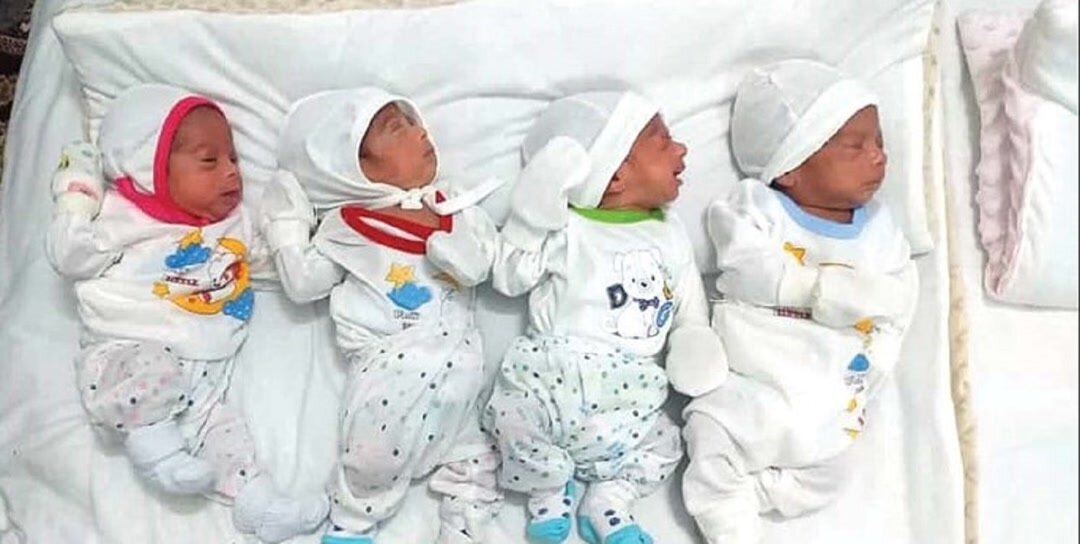 تولد نوزادان چهار قلو در کرمانشاه