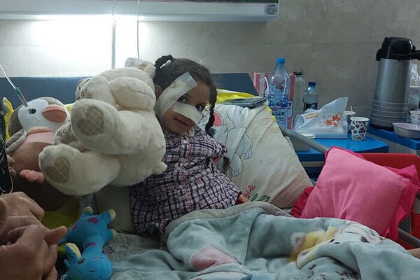 عیادت شهردار تبریز از دختر بچه آسیبدیده بر اثر حمله سگهای بلاصاحب