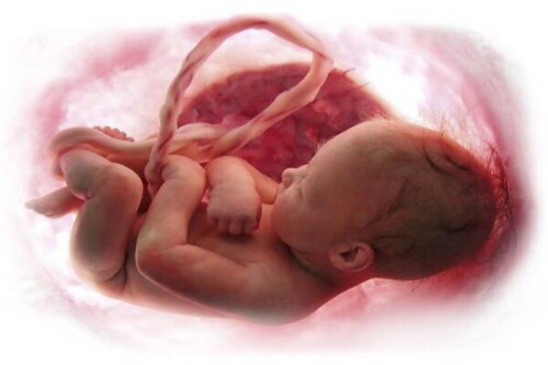 رویایی که با یک تصمیم خاموش میشود