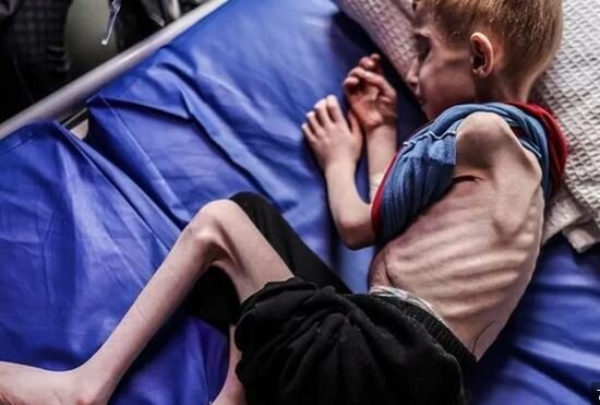 کودککشی اسرائیل جنایتکار با گرسنگی دادن هدفمند غزهایها