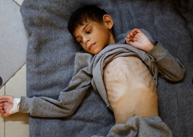 کودککشی اسرائیل جنایتکار با گرسنگی دادن هدفمند غزهایها