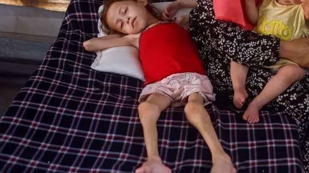 کودککشی اسرائیل جنایتکار با گرسنگی دادن هدفمند غزهایها