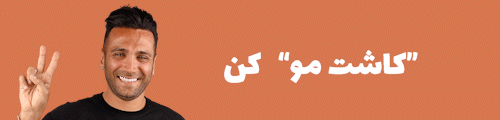 کاشت مو کاشت مو