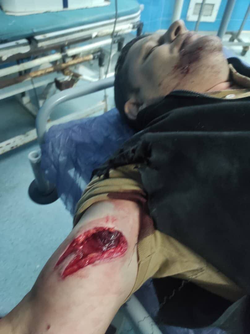 عیادت مدیرکل منابع طبیعی گیلان از جنگلبان آسیب دیده تالشی