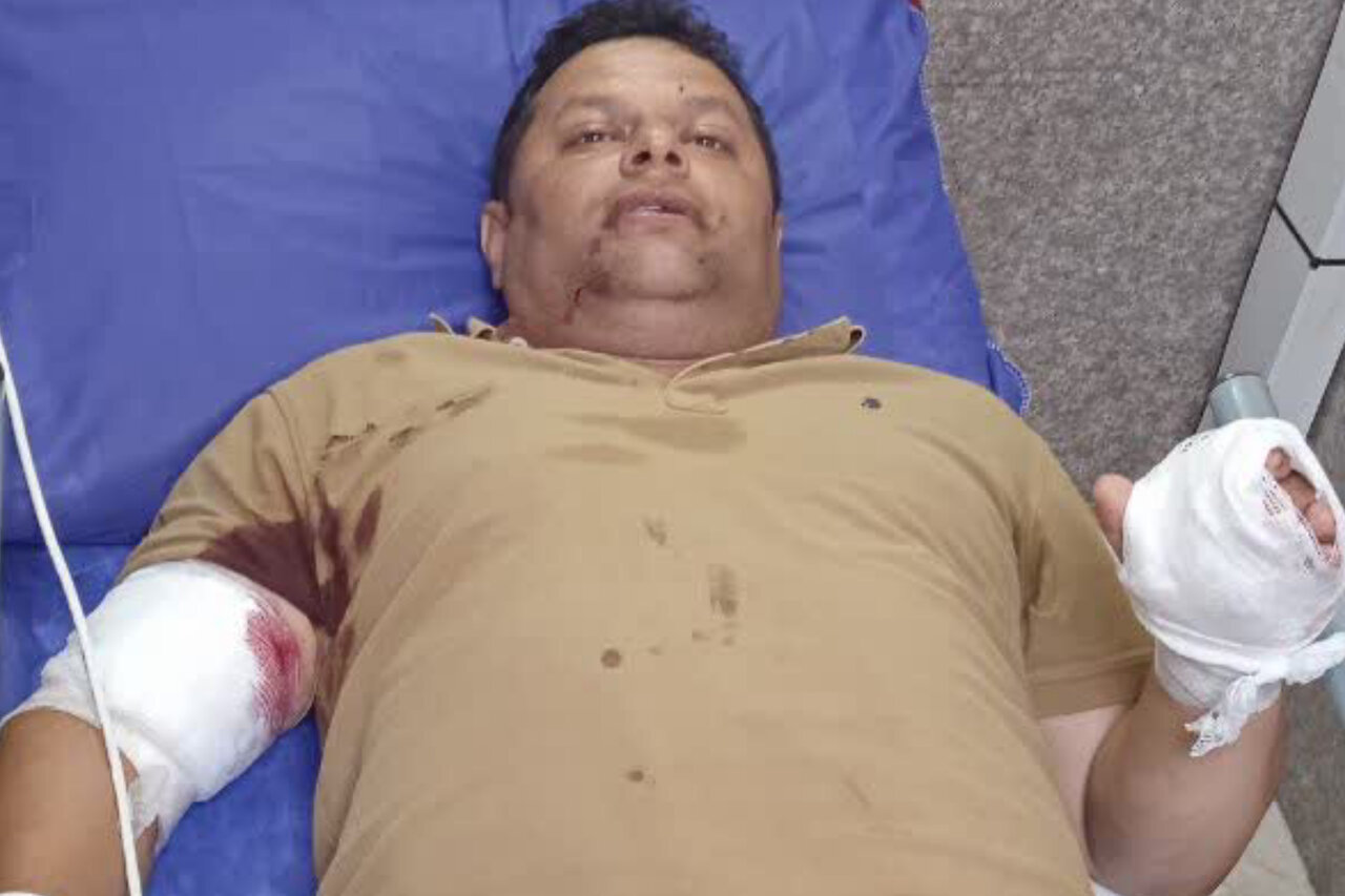 عیادت مدیرکل منابع طبیعی گیلان از جنگلبان آسیب دیده تالشی