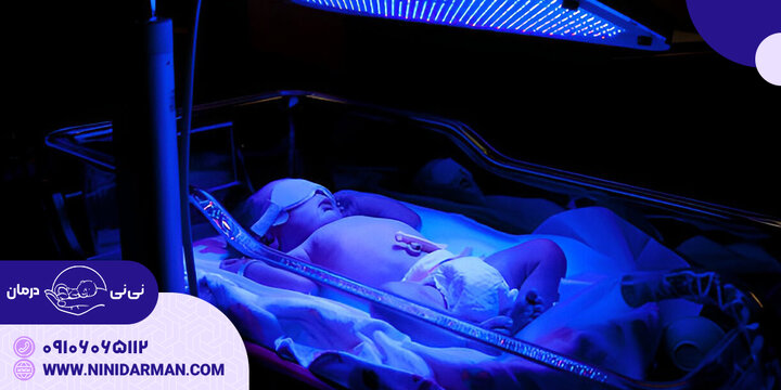 درمان فوری زردی نوزاد تازه متولد شده درمان فوری زردی نوزاد تازه متولد شده