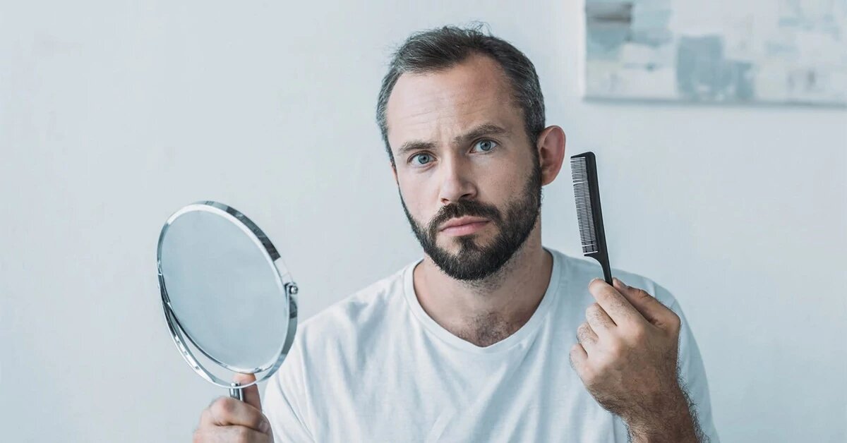 آیا ریزش موی هورمونی برگشت پذیر است؟ روشهای درمان و علتها