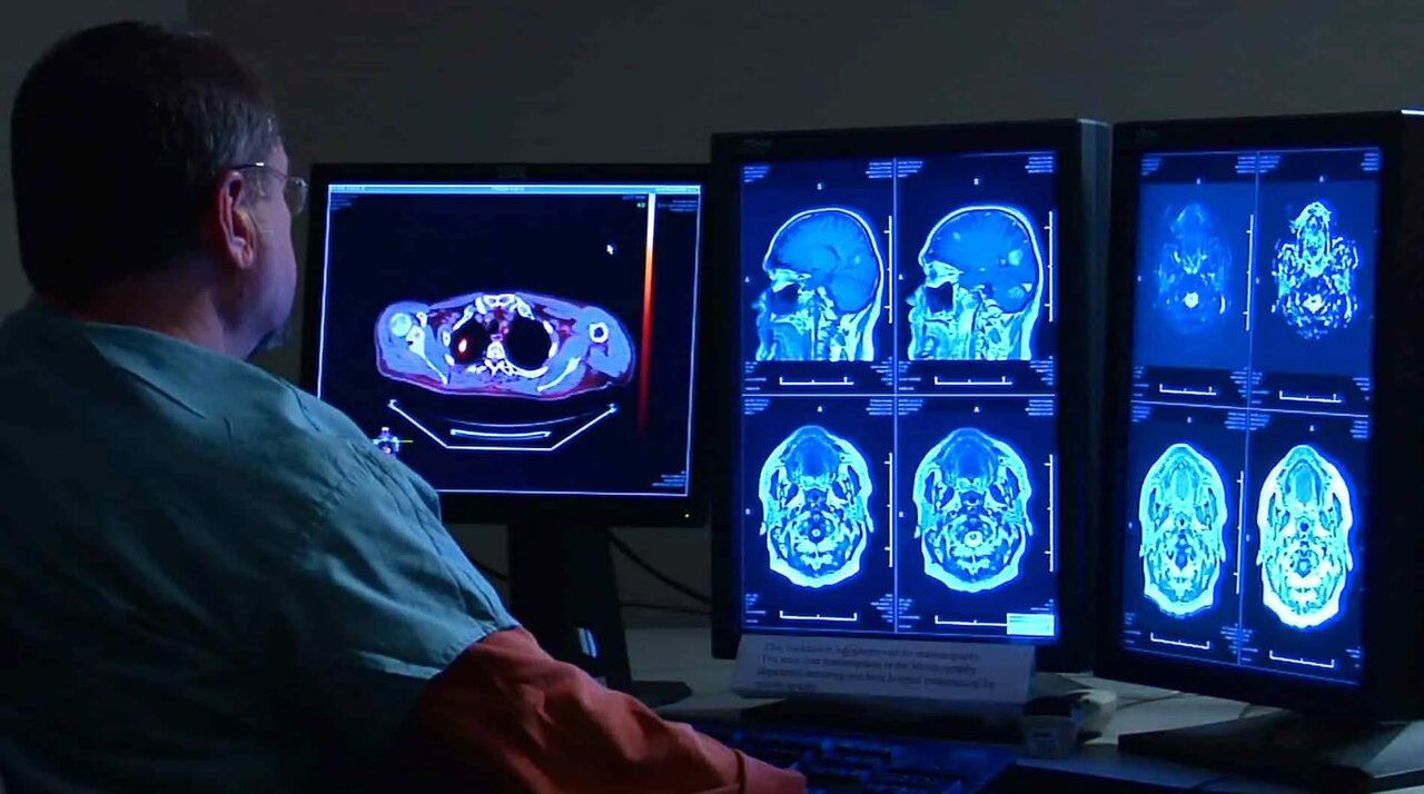 تحریک مغز در خانه؛ درمان جدید افسردگی امید تازهای میآفریند
